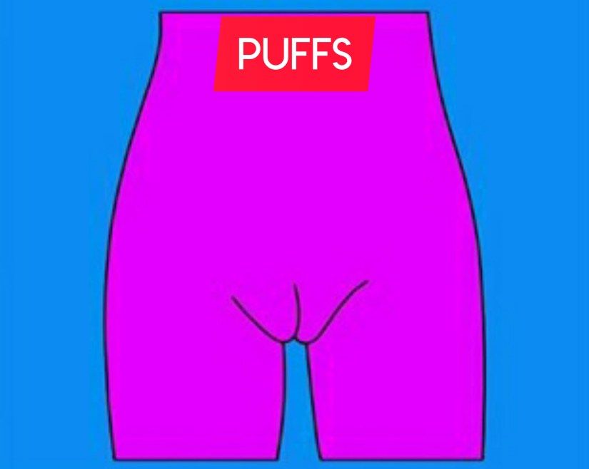 What type of VGNA you have ? Bhede Nepal